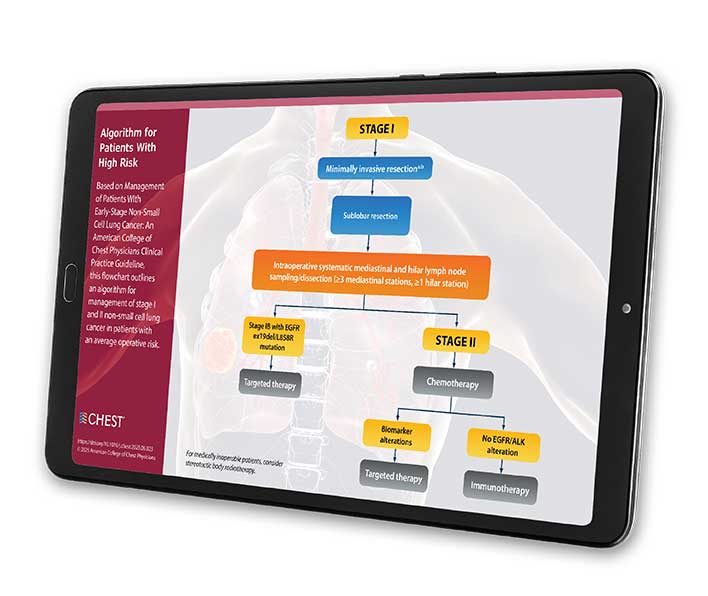 High_Management-of-Patients-with-Early-Stage-NSCLC-guideline_infographic