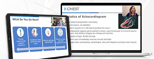 Echocardiography of the Right Heart