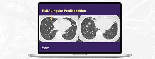 A laptop showing a screenshot of an radiology webinar, on a green background