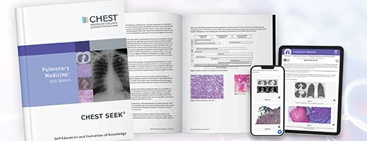 CHEST SEEK® Pulmonary Medicine: 35th Edition book
