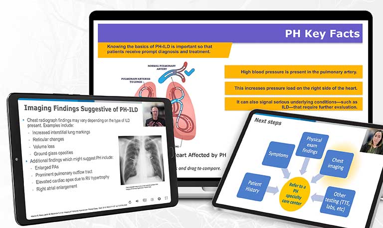 Bridging Specialties®: Timely Diagnosis for PH-ILD Decision-Making Tool displayed on a tablet screen.